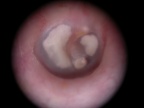 yoyo cartilage